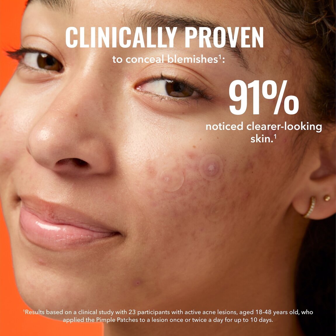 Good Molecules Pimple Patches 60ct alternative view 4.